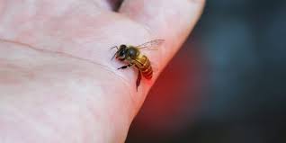 arı sokmasına ne iyi gelir